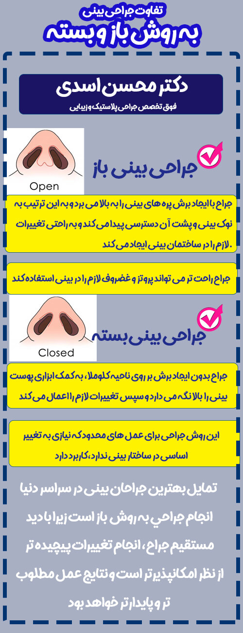 اینفوگرافیک روش باز و بسته