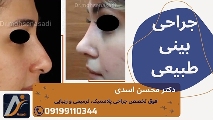 مدل بینی طبیعی