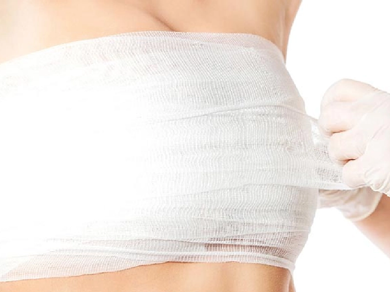 تعویض پروتز سینه