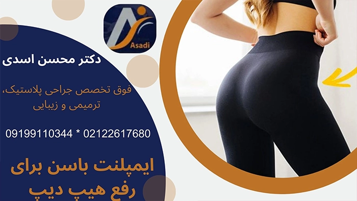 ایمپلنت باسن برای رفع هیپ دیپ