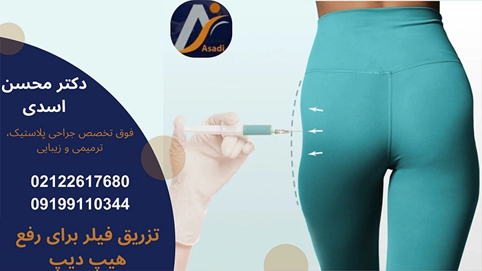 تزریق فیلر برای رفع هیپ دیپ