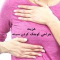 هزینه جراحی کوچک کردن سینه - هزینه ماموپلاستی