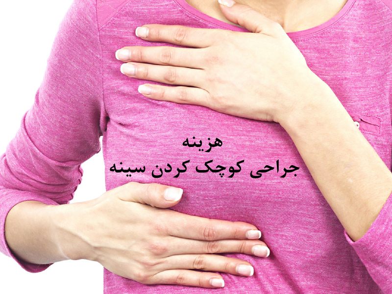 هزینه جراحی کوچک کردن سینه - هزینه ماموپلاستی