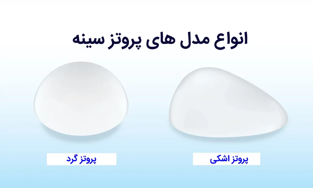 پروتز سینه اشکی و پروتز سینه گرد