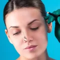 پیوند غضروف بینی