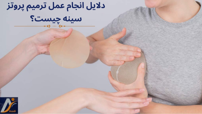 دلایل ترمیم پروتز سینه
