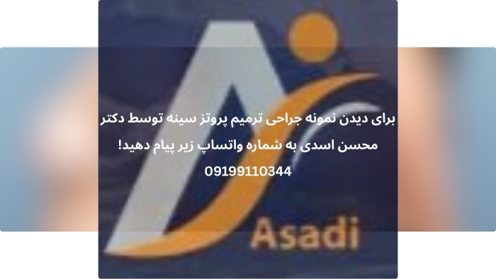 عمل ترمیم پروتز سینه