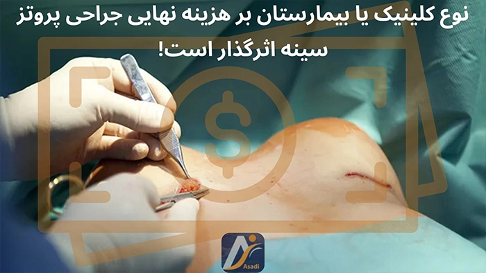 هزینه بیمارستان برای جراحی پروتز سینه