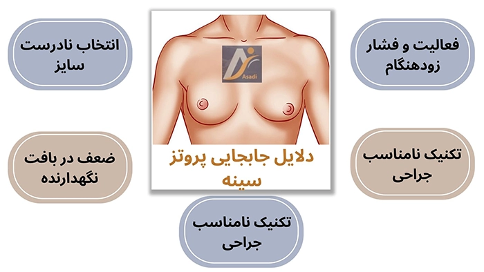 دلایل جابجایی پروتز سینه