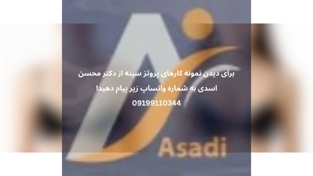 سایز مناسب پروتز سینه