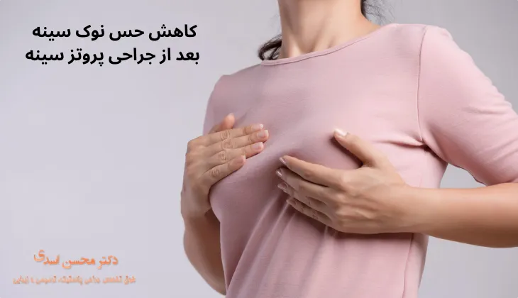 کاهش حس نوک سینه بعد از جراحی پروتز سینه