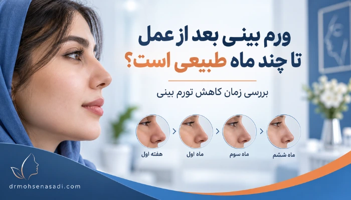 ورم بینی بعد از عمل تا چند ماه طبیعی است؟