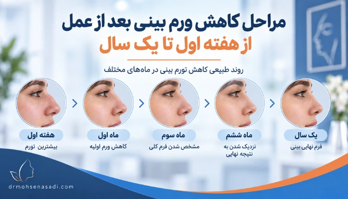 اینفوگرافیک روند طبیعی کاهش تورم بینی بعد از رینوپلاستی در ماه‌های مختلف
